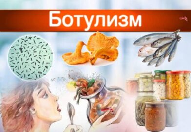 Что нужно знать о ботулизме?